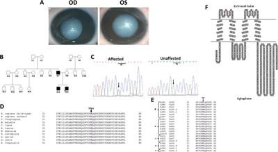 Molecular diagnosis of autosomal dominant congenital cataract in two families from North India reveals a novel and a known variant in GJA8 and GJA3